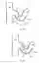 Fig. 35 - Catheter Apparatuses, Systems, and Methods for Renal Neuromodulation