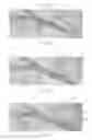 Fig. 37 - Catheter Apparatuses, Systems, and Methods for Renal Neuromodulation