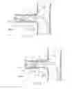 Fig. 14 - Catheter Apparatuses, Systems, and Methods for Renal Neuromodulation