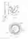 Fig. 32 - Catheter Apparatuses, Systems, and Methods for Renal Neuromodulation