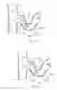 Fig. 33 - Catheter Apparatuses, Systems, and Methods for Renal Neuromodulation
