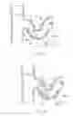Fig. 35 - Catheter Apparatuses, Systems, and Methods for Renal Neuromodulation