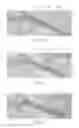 Fig. 37 - Catheter Apparatuses, Systems, and Methods for Renal Neuromodulation