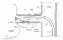 Fig. 01 - Catheter Apparatuses, Systems, and Methods for Renal Neuromodulation
