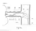Fig. 08 - Catheter Apparatuses, Systems, and Methods for Renal Neuromodulation