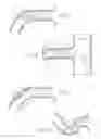 Fig. 10 - Catheter Apparatuses, Systems, and Methods for Renal Neuromodulation