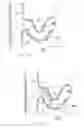 Fig. 30 - Catheter Apparatuses, Systems, and Methods for Renal Neuromodulation