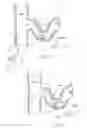 Fig. 31 - Catheter Apparatuses, Systems, and Methods for Renal Neuromodulation