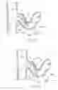 Fig. 33 - Catheter Apparatuses, Systems, and Methods for Renal Neuromodulation