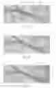 Fig. 37 - Catheter Apparatuses, Systems, and Methods for Renal Neuromodulation