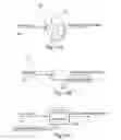 Fig. 14 - SYSTEM AND METHOD FOR MICROABLATION OF TISSUE