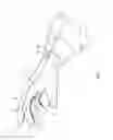 Fig. 05 - Surgical glove systems and method of using the same