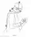 Fig. 07 - Surgical glove systems and method of using the same