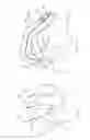 Fig. 10 - Surgical glove systems and method of using the same