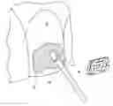 Fig. 01 - ADJUSTABLE ORTHODONTIC BRACKET AND METHOD