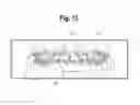 Fig. 10 - TOOTH ATTACHMENT PLACEMENT DEVICE