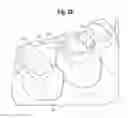 Fig. 19 - TOOTH ATTACHMENT PLACEMENT DEVICE