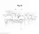 Fig. 20 - TOOTH ATTACHMENT PLACEMENT DEVICE