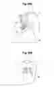 Fig. 31 - TOOTH ATTACHMENT PLACEMENT DEVICE