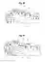 Fig. 35 - TOOTH ATTACHMENT PLACEMENT DEVICE