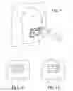 Fig. 05 - ADJUSTABLE ORTHODONTIC BRACKET AND METHOD