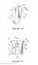Fig. 09 - Orthodontic bracket