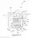 Fig. 22 - Orthodontic bracket