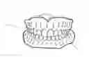 Fig. 01 - Apparatus and methods of making denture devices