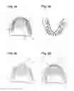 Fig. 05 - Apparatus and methods of making denture devices