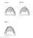 Fig. 06 - Apparatus and methods of making denture devices