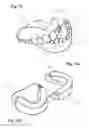 Fig. 10 - Apparatus and methods of making denture devices