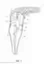 Fig. 10 - Apparatus and methods for cleaning teeth and root canals
