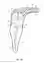 Fig. 12 - Apparatus and methods for cleaning teeth and root canals