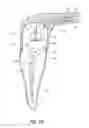 Fig. 20 - Apparatus and methods for cleaning teeth and root canals