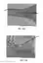 Fig. 48 - Apparatus and methods for cleaning teeth and root canals