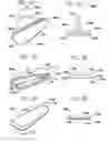 Fig. 11 - Systems and methods for incontinence control