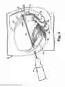 Fig. 03 - Implantable article and method