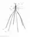 Fig. 01 - Implantable medical device with improved orientation