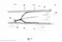 Fig. 06 - Implantable medical device with improved orientation