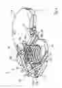 Fig. 04 - Ligament-tensioning device and method