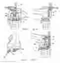 Fig. 08 - Ligament-tensioning device and method
