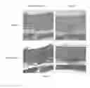 Fig. 11 - SILK FIBROIN HYDROGELS AND USES THEREOF