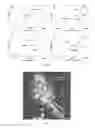 Fig. 16 - SILK FIBROIN HYDROGELS AND USES THEREOF
