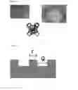 Fig. 05 - INTRAOCULAR LENS WITH FINE PATTERN