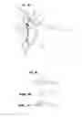 Fig. 04 - Intraocular lens