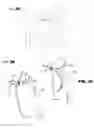 Fig. 09 - Intraocular lens