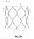 Fig. 04 - Bi-Leaflet Mitral Valve Design