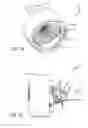 Fig. 17 - Stentless support structure