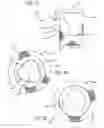 Fig. 19 - Stentless support structure