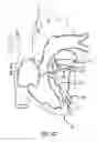 Fig. 22 - Stentless support structure